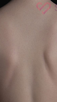 FANREAL - Real Skin Texture (RST) текстура человеческой кожи (фото 14)